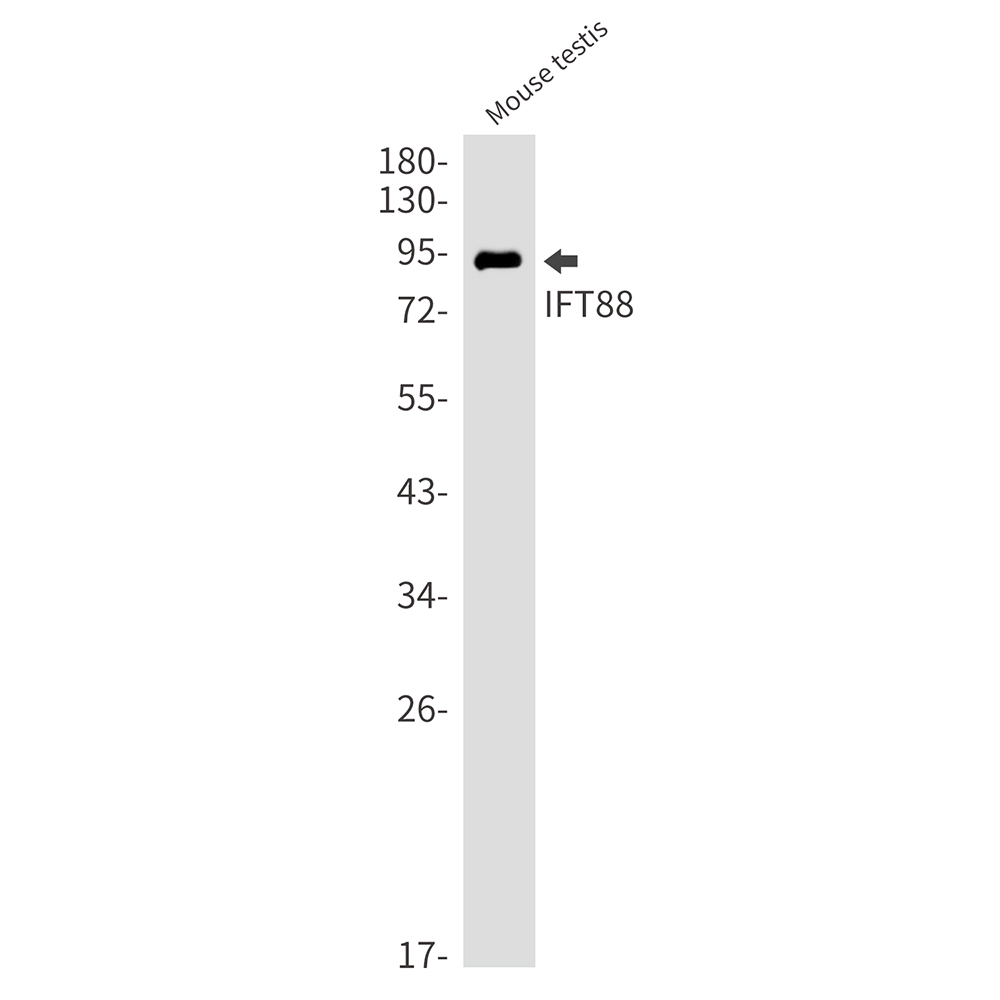 Rabbit monoclonal antibody