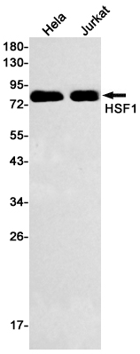 Rabbit monoclonal antibody