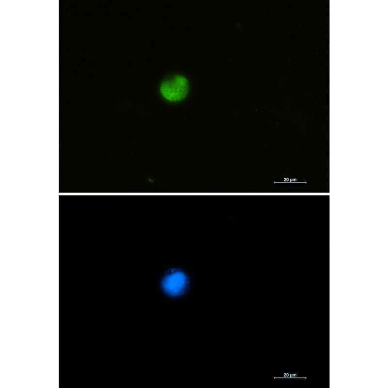 Rabbit monoclonal antibody
