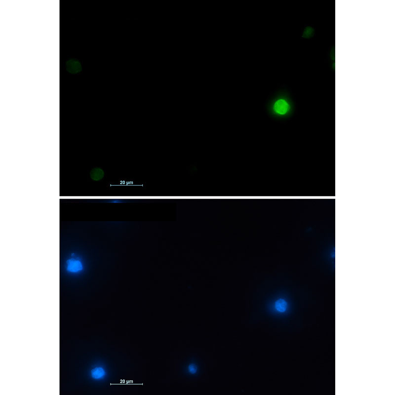 Rabbit monoclonal antibody