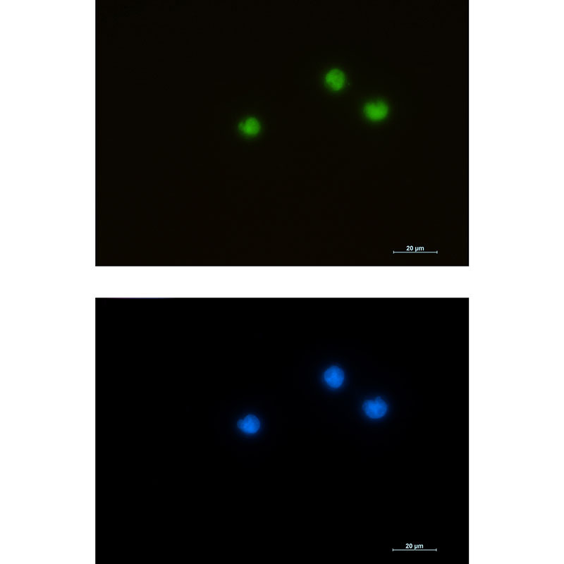 Rabbit monoclonal antibody