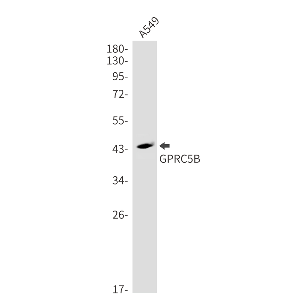 Rabbit monoclonal antibody