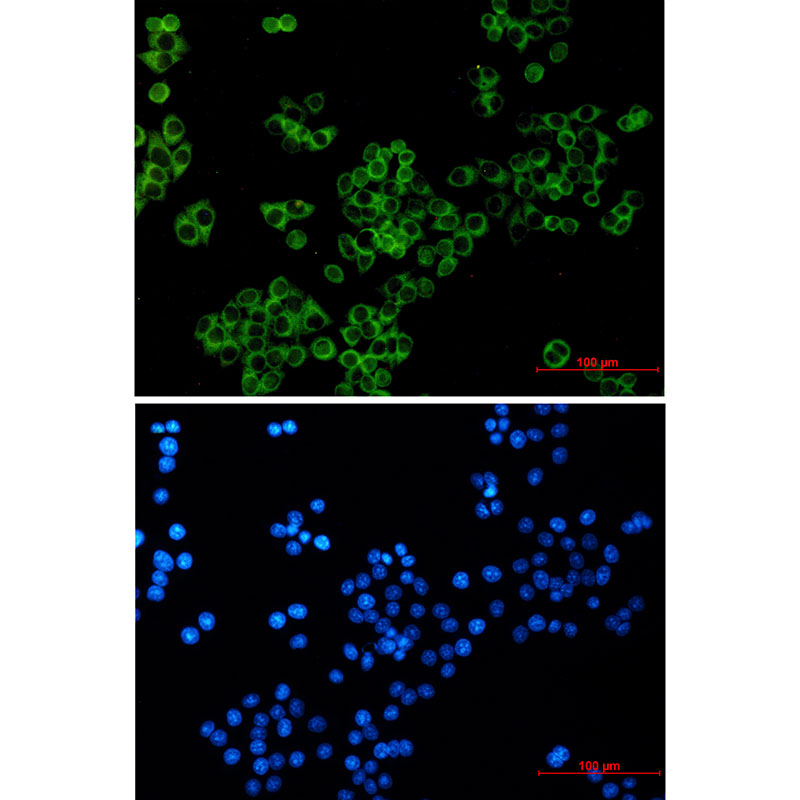 Rabbit monoclonal antibody