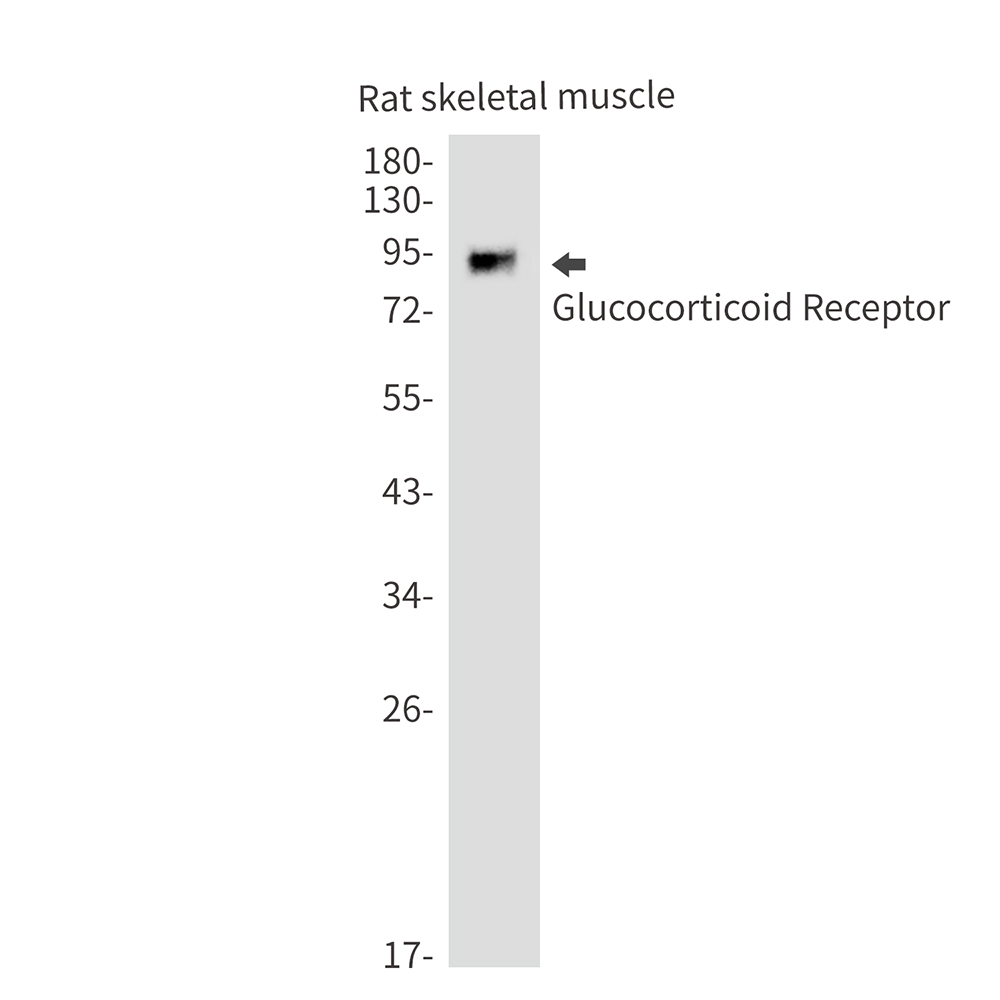 Rabbit monoclonal antibody