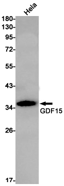Rabbit monoclonal antibody