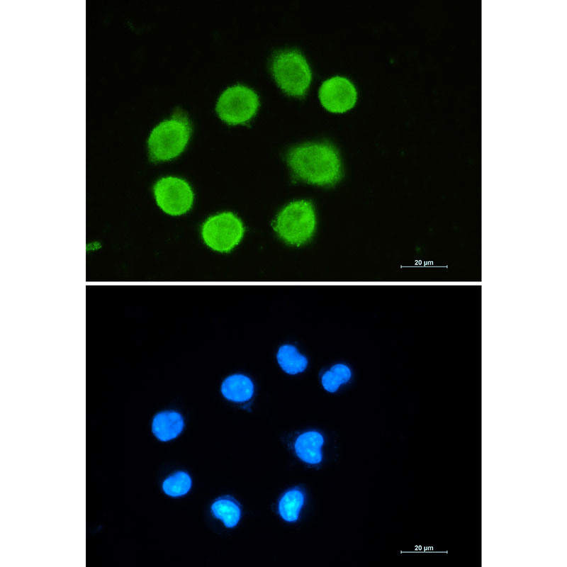Rabbit monoclonal antibody
