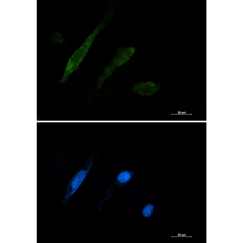 Rabbit monoclonal antibody