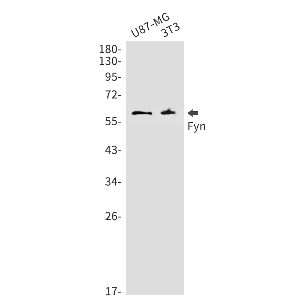 Rabbit monoclonal antibody