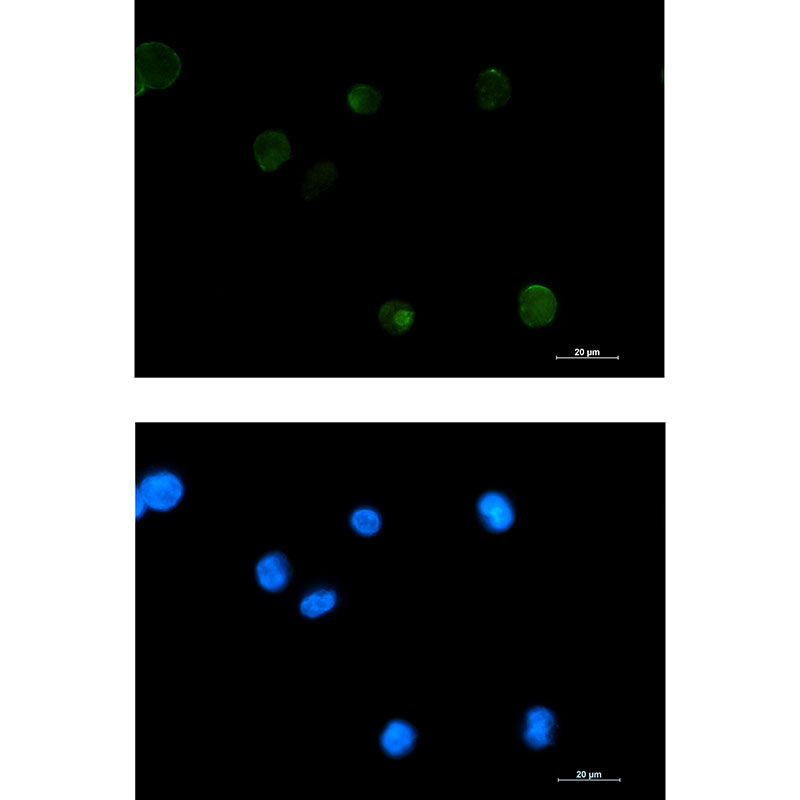 Rabbit monoclonal antibody