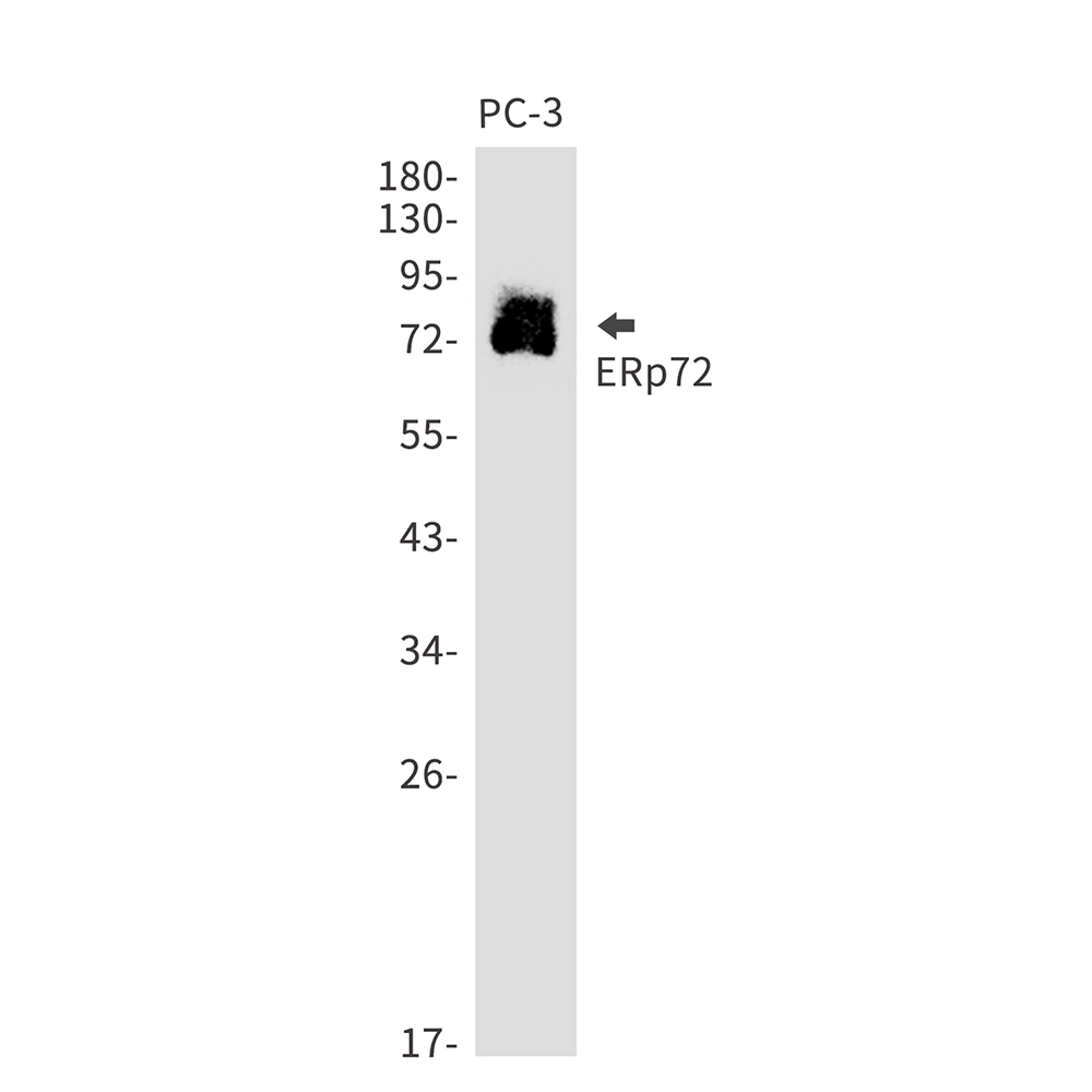 Rabbit monoclonal antibody