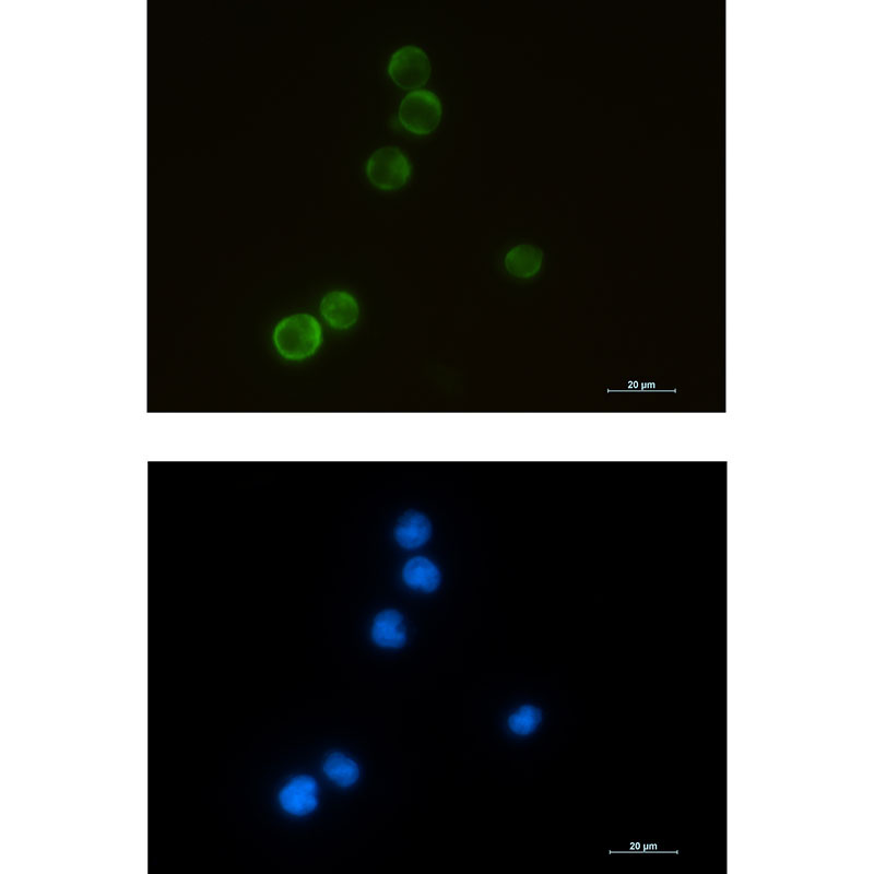 Rabbit monoclonal antibody