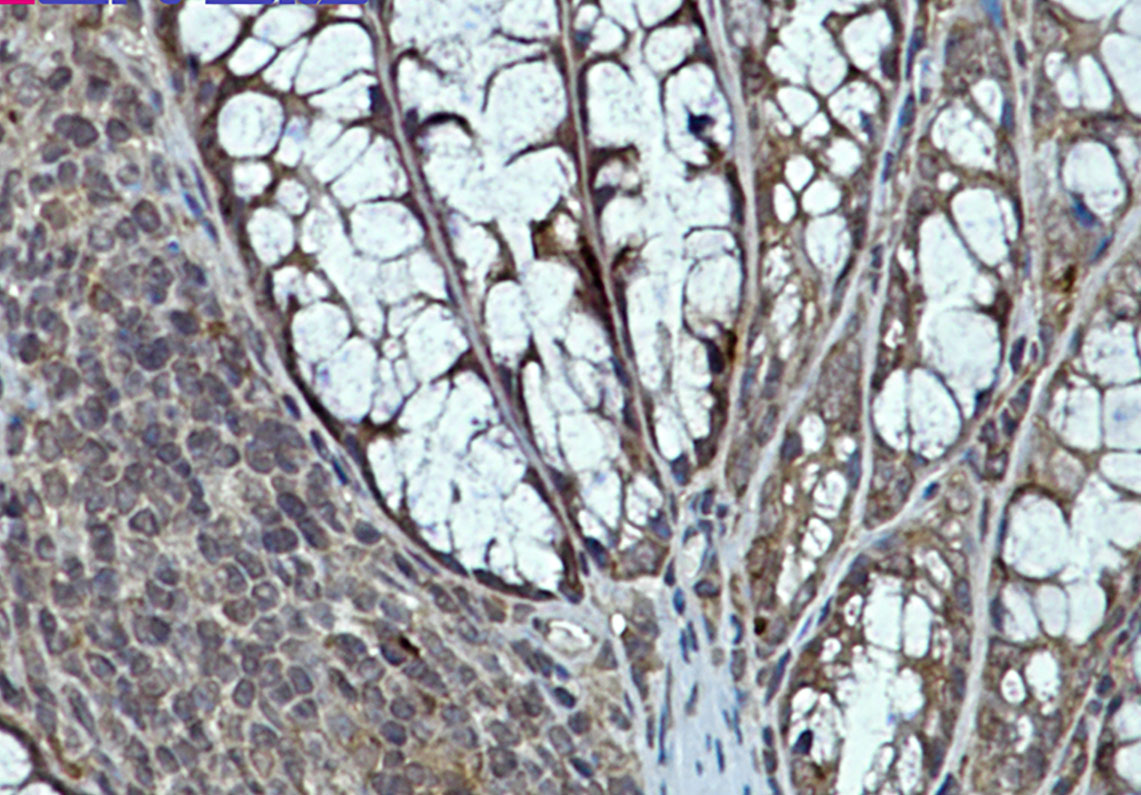 Rabbit monoclonal antibody