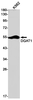 Rabbit monoclonal antibody