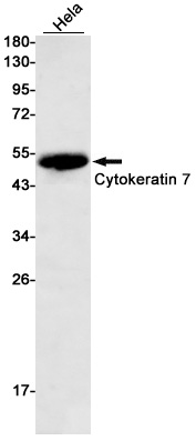 Rabbit monoclonal antibody