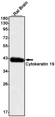 Rabbit monoclonal antibody