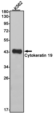 Rabbit monoclonal antibody