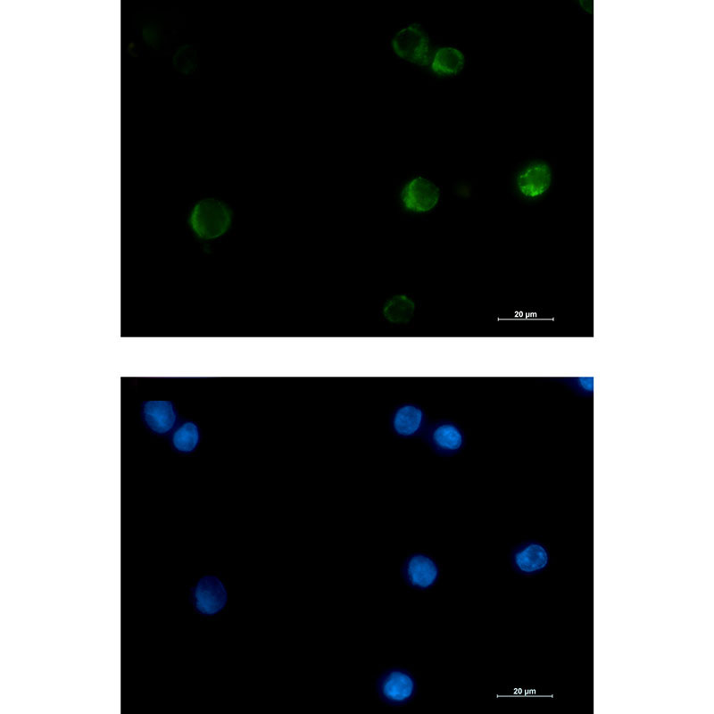 Rabbit monoclonal antibody