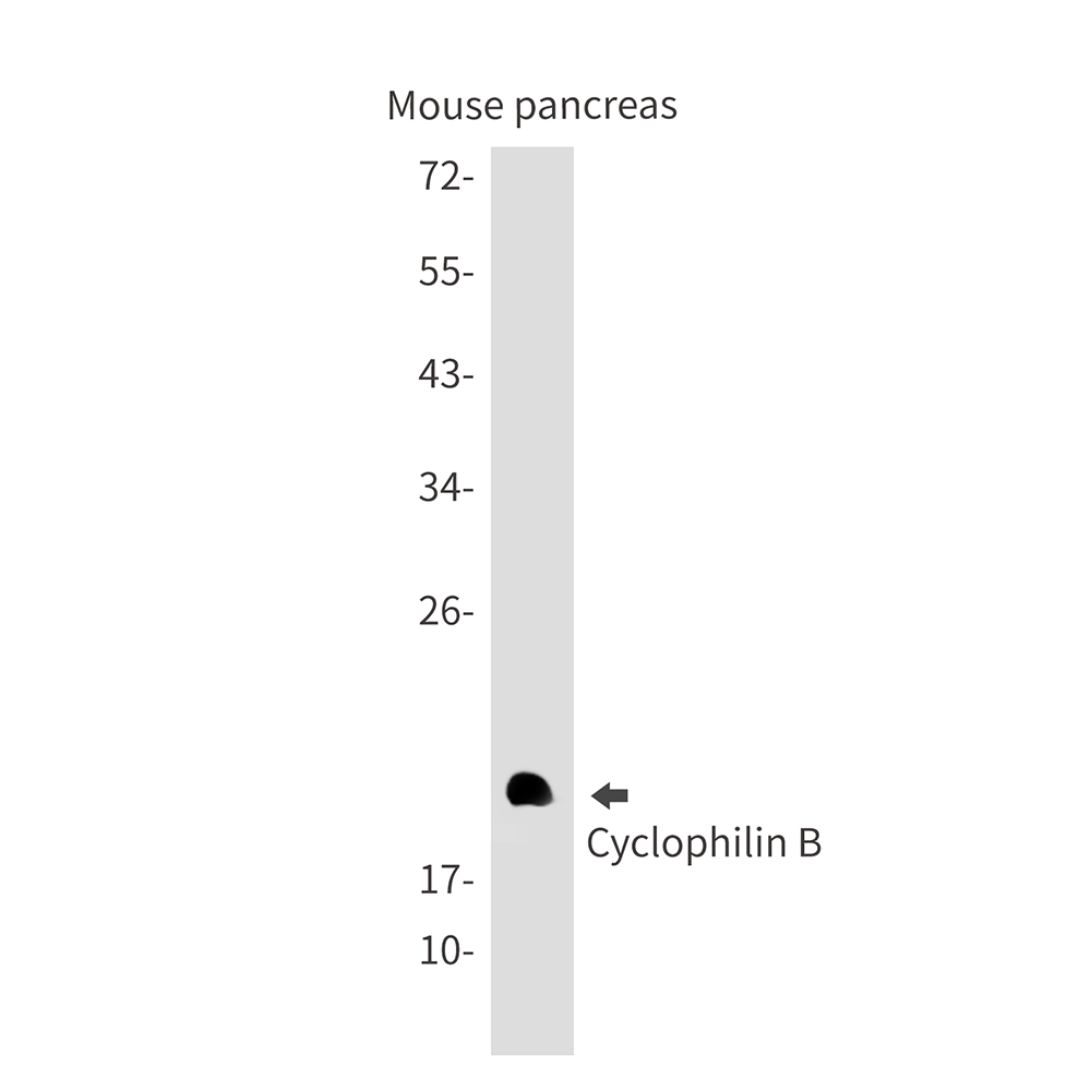 Rabbit monoclonal antibody
