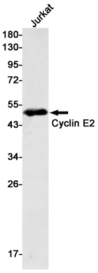 Rabbit monoclonal antibody