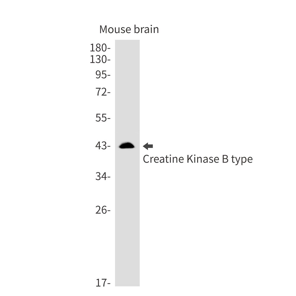 Rabbit monoclonal antibody