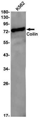 Rabbit monoclonal antibody