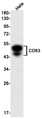 Rabbit monoclonal antibody