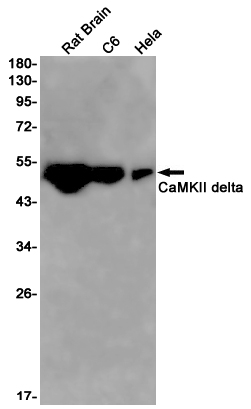 Rabbit monoclonal antibody