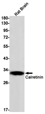Rabbit monoclonal antibody