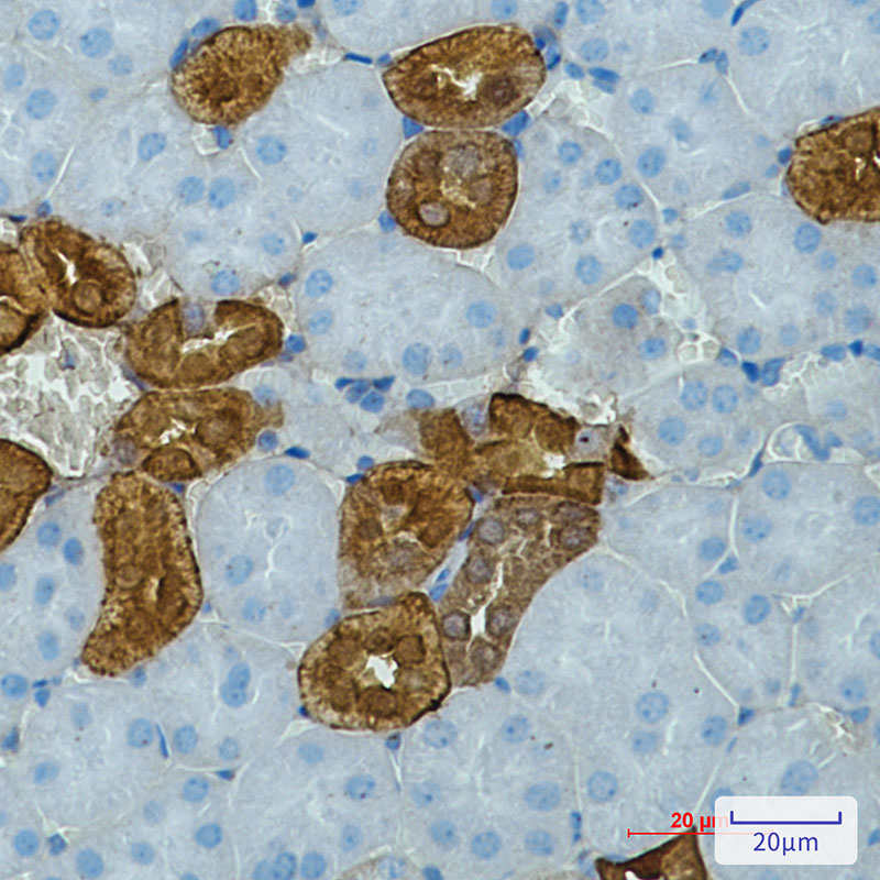 Rabbit monoclonal antibody