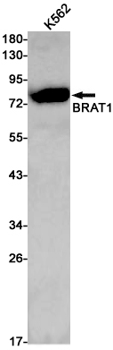 Rabbit monoclonal antibody