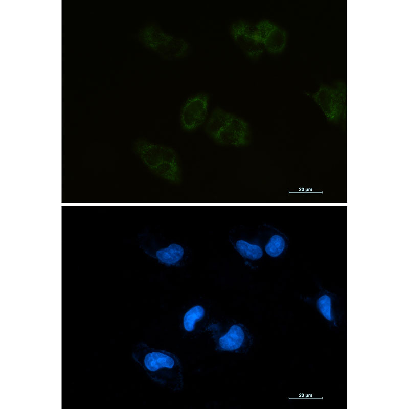 Rabbit monoclonal antibody