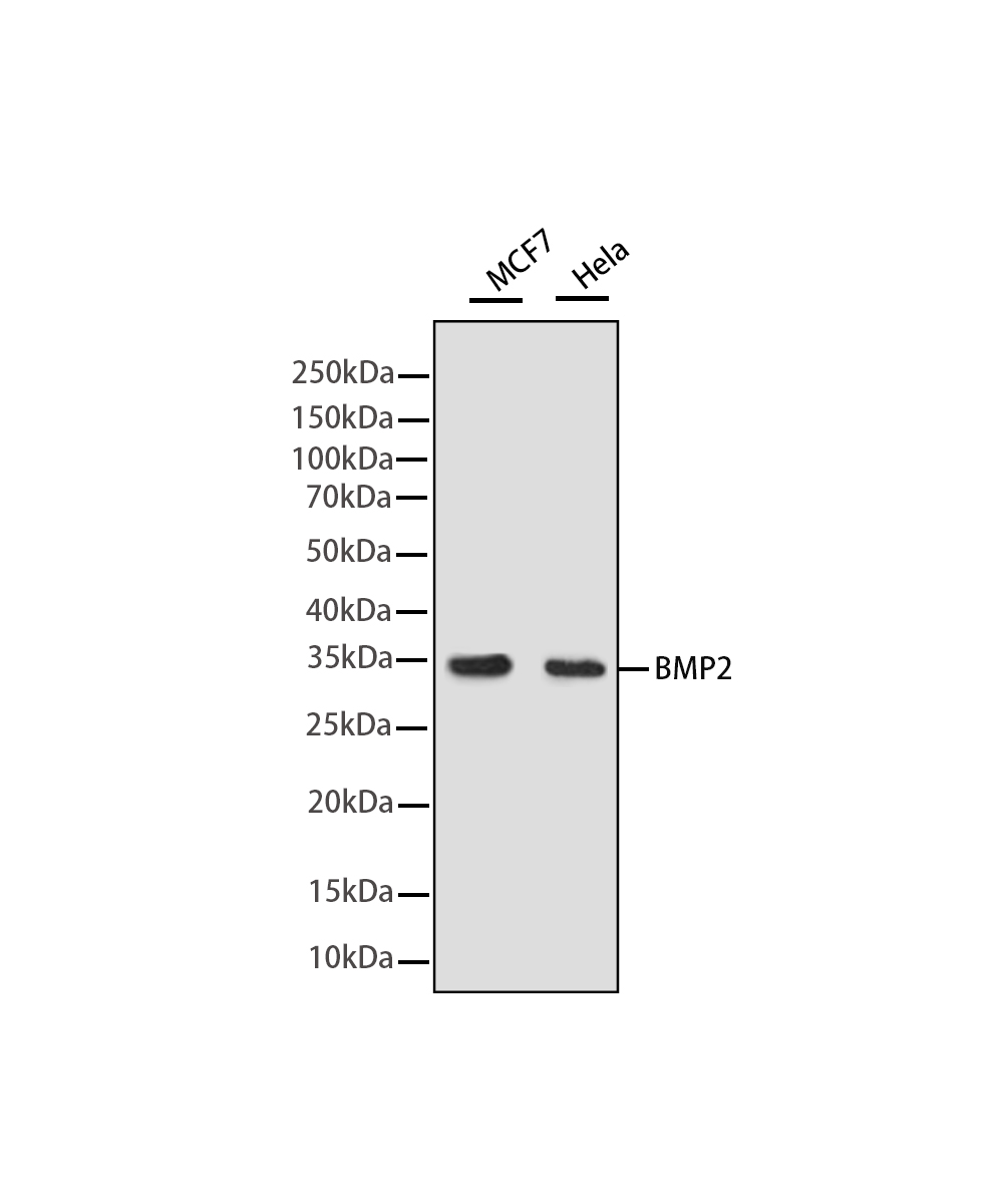 Rabbit monoclonal antibody
