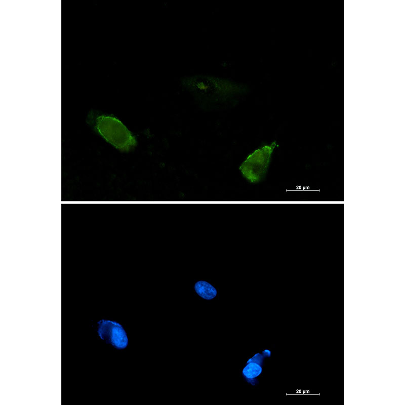 Rabbit monoclonal antibody