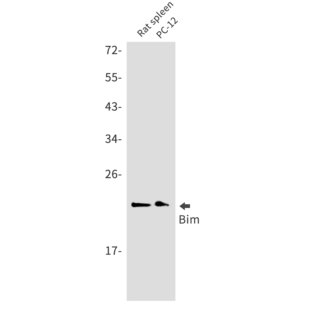 Rabbit monoclonal antibody