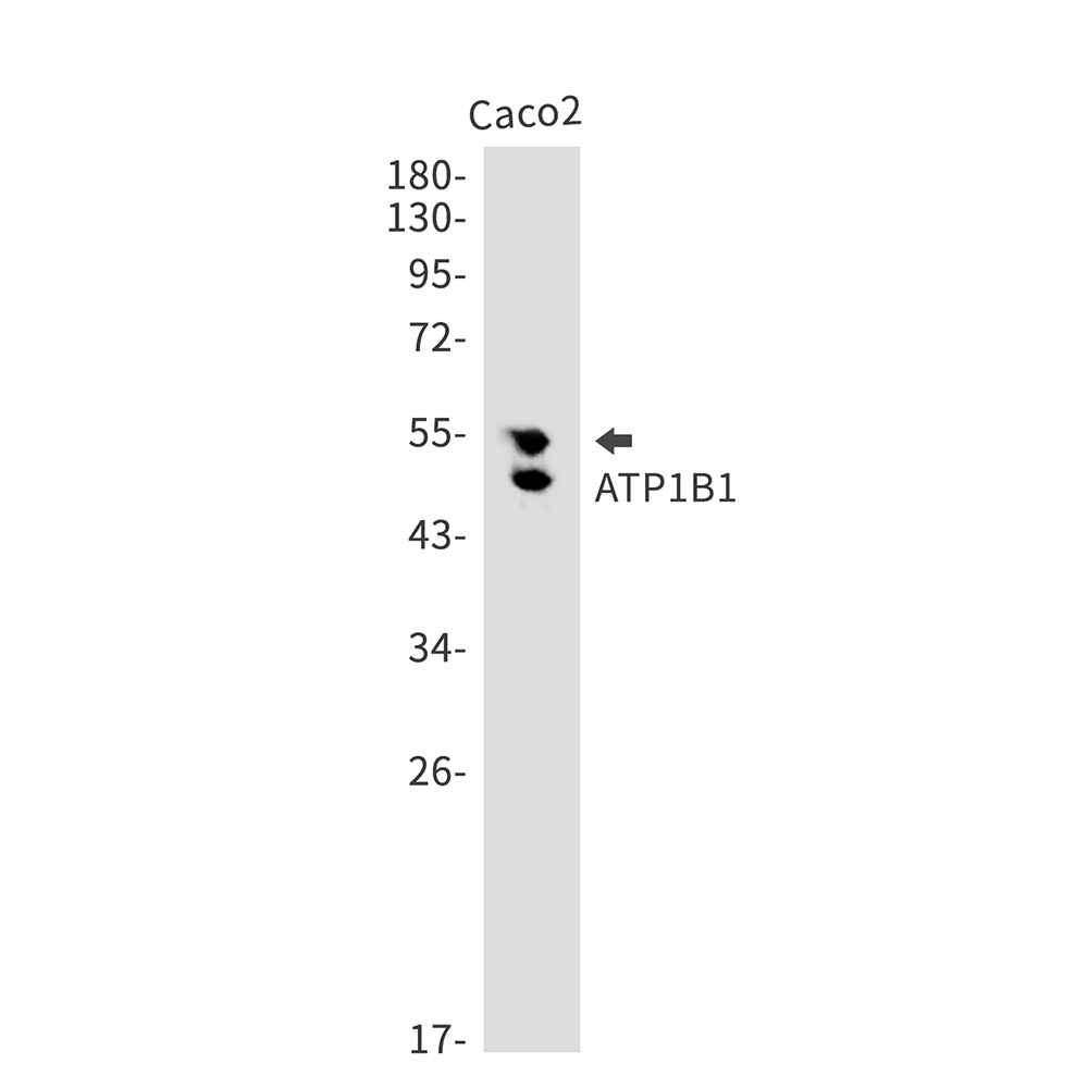 Rabbit monoclonal antibody