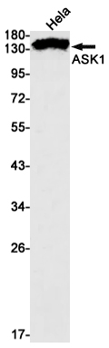Rabbit monoclonal antibody