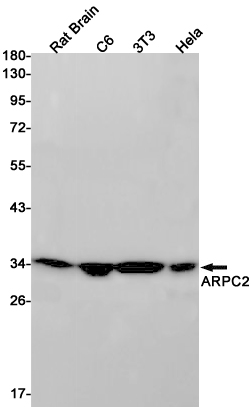 Rabbit monoclonal antibody