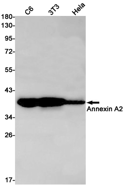 Rabbit monoclonal antibody
