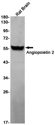 Rabbit monoclonal antibody