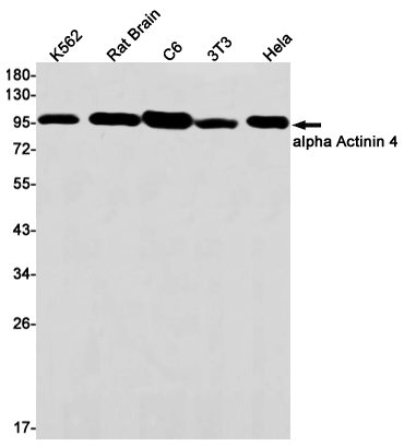 Rabbit monoclonal antibody