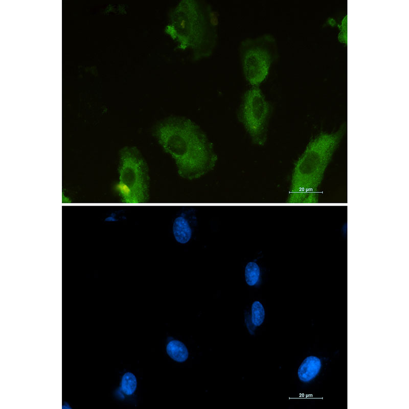 Rabbit monoclonal antibody