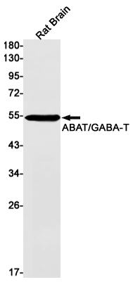 Rabbit monoclonal antibody