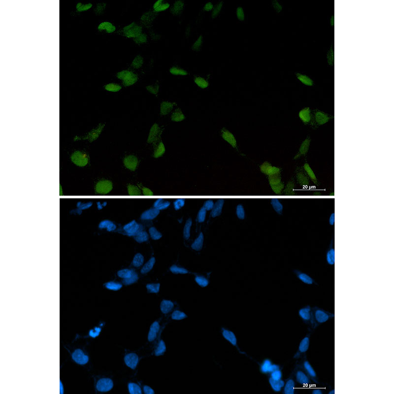 Rabbit monoclonal antibody