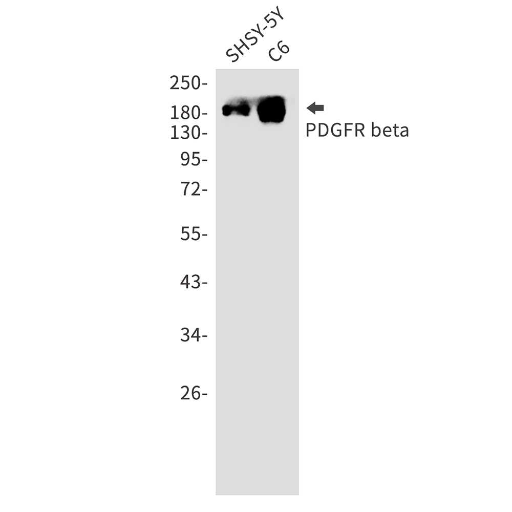 Rabbit monoclonal antibody
