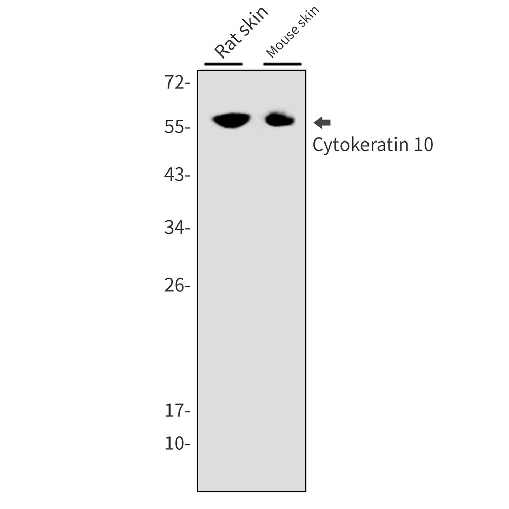 Rabbit monoclonal antibody