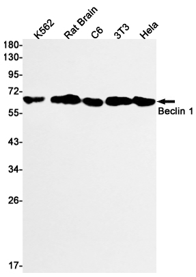Rabbit monoclonal antibody