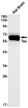 Rabbit monoclonal antibody