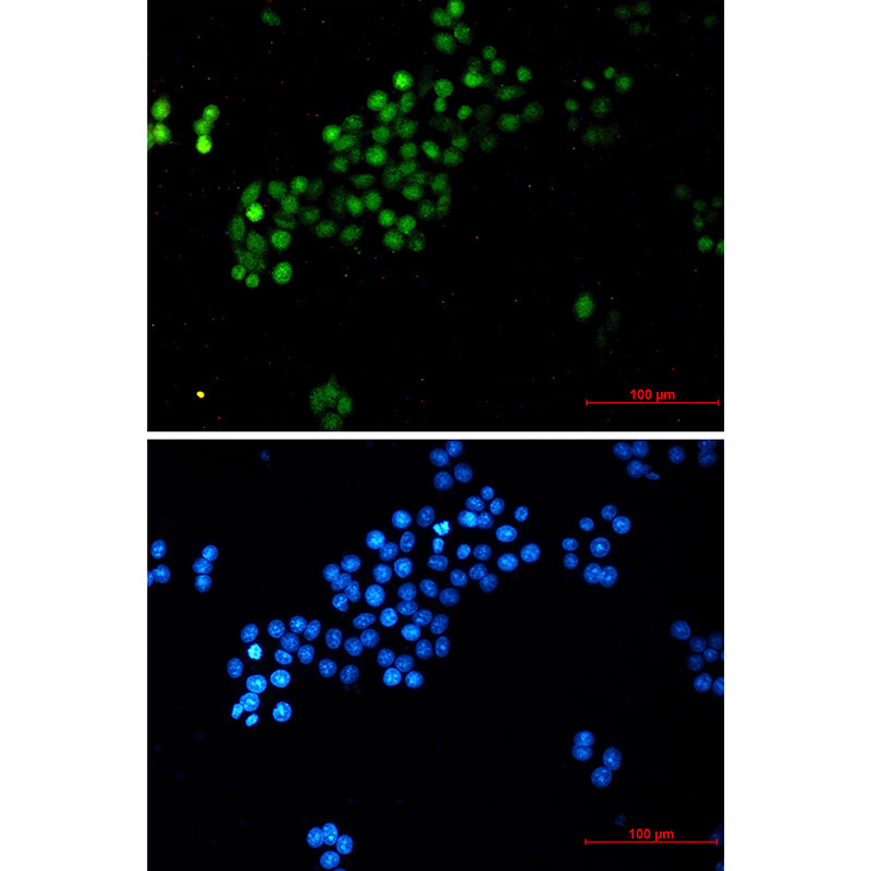 Rabbit monoclonal antibody