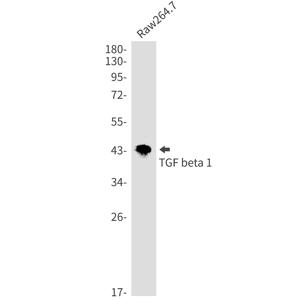 Rabbit monoclonal antibody