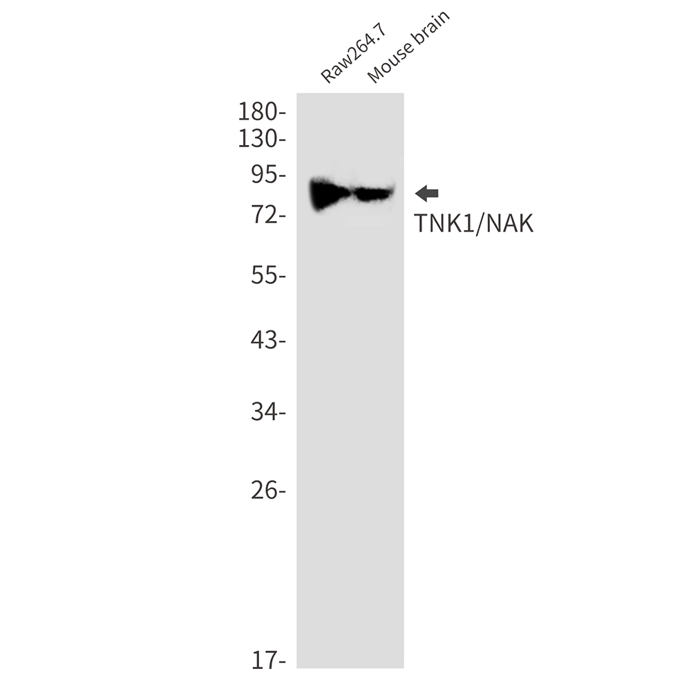 Rabbit monoclonal antibody